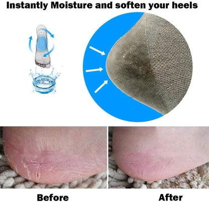 Codream Vented Moisturizing Socks with Gel Lotion for Dry, Cracked Heels: Spa-Grade Heel Treatment to Soften and Hydrate - 2 Pairs for Complete Foot Care